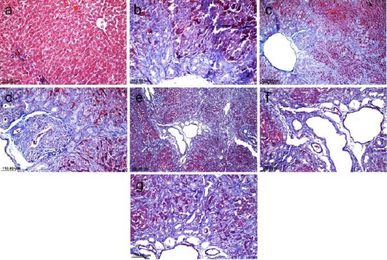 Masson’s trichrome staining of rat liver sections (×40 & ×80). Sham liver tissue shows traces of connective tissue (blue) in the normal hepatic tissue present mainly around the main blood vessels (a). Bile duct-ligated rat liver tissue shows massive fibrosis in liver tissue with thick fibrous tissue expanded along the portal tract and extended into the periportal region. Lost normal architecture and dilated bile ducts was also observed (b). Moreover, the liver treated with silymarin shows also marked decrease in connective tissue (c & d). However, liver treated with AM1241 shows only a few blue stained collagen bundles surrounding hepatic nodules (e, f & g)