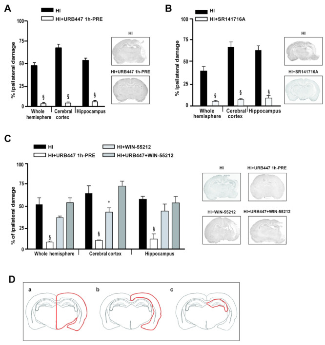 Evaluation of brain damage after neonatal hypoxia-ischemia (HI) and treatment with URB447, SR141716A, and WIN-55,212-2. Infarct volume measured in the whole hemisphere, cerebral cortex, and hippocampus of 14-day-old rats subjected to HI on P7 and treated with (A) vehicle (HI) or URB447 1 mg/kg 1 h before HI (HI+URB447 1h-PRE); (B) vehicle (HI) or SR141716A 1 mg/kg 1 h before HI (HI+SR141716A); (C) vehicle (HI) or URB447 1 mg/kg 1 h before HI (HI+URB447), or WIN-55,212-2 1 mg/kg 1 h and 30 min before HI (HI+WIN-55,212-2), or URB447 plus WIN-55,212-2 (HI+URB447+WIN-55,212-2). Images represent coronal brain sections at the hippocampal level of each experimental group stained with toluidine blue. Results are expressed as percentage of ipsilateral damage calculated from bilateral regional volumes using the formula 100(L – R)/L, where L is the volume of the contralateral region and R is the volume of the ipsilateral region (N = 10/group). * P < 0.05, § P < 0.001, Mann–Whitney test and one-way ANOVA followed by Newman–Keuls multiple comparison test. (D) Representative drawing of the brain areas—whole hemisphere (a), cerebral cortex (b), and hippocampus (c)—analyzed in the histological experiments reported in panels A, B, and C.