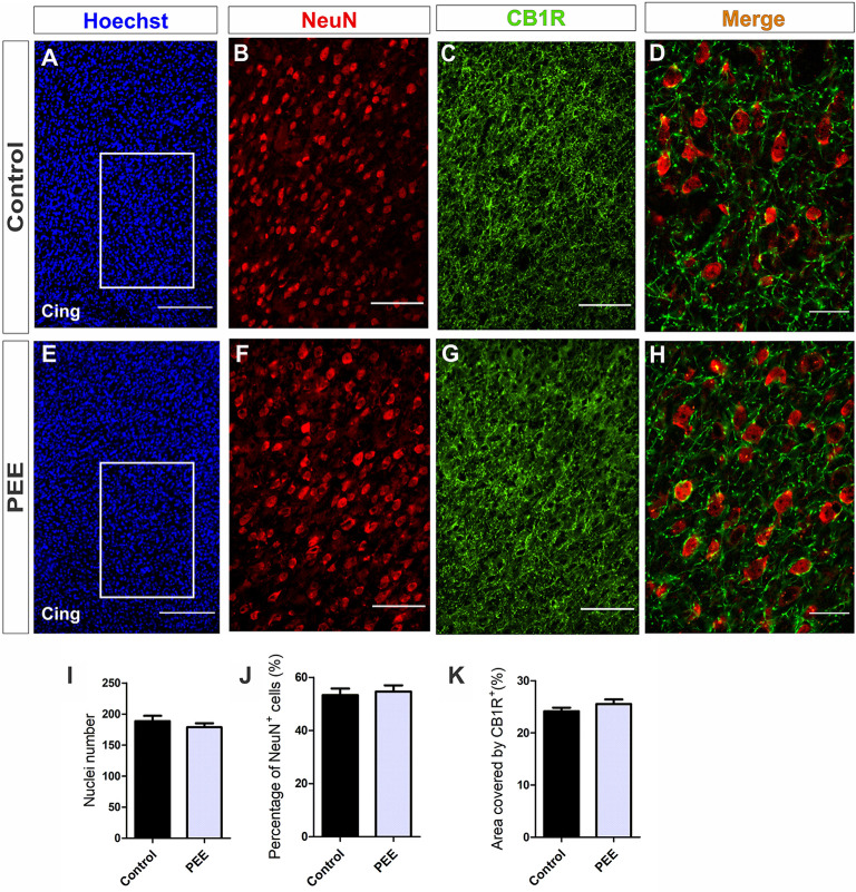 The population of mature neurons and the area covered by CB1 receptor (CB1R) are conserved in the anterior cingulate cortex (ACC) of PEE adults. Images of coronal sections of adult male mouse brains with Hoechst staining (blue) and immunofluorescence for NeuN (red) and CB1R (green) taken on an inverted microscope with spinning disk unit (SDU). Sections at the level of the ACC of a Control (A) and PEE brain (E) at low magnification. Sections at the level of the ACC of a Control (B,C) and PEE brain (F,G) at higher magnification. The merge of NeuN and CB1R immunofluorescence is shown at 60× magnification (D,H). In (A,D) photomicrographs, the cingulum is indicated with the abbreviation cing. Nuclei number (I), percentage of NeuN+ cells (%, J), area covered by CB1R (%, K). Data expressed as the mean ± SEM (Control n = 5 each one from five different control litters, PEE n = 5 each one from five different ethanol PEE litters); all parameters were analyzed by Student’s t-test. Scale bars: 200 μm (A,E), 75 μm (B,C,F,G), 25 μm (D,H).