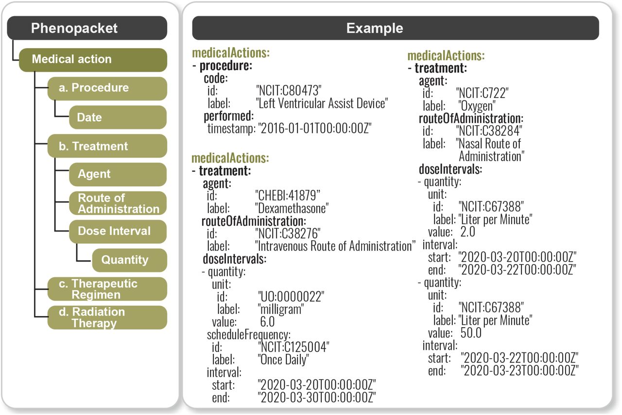 Phenopacket MedicalAction representation.Left panel: components of a MedicalAction in a Phenopacket. Right panel: example using COVID medical actions: implantation of a left ventricular assist device in 2016 (this information from the past medical history is important as it represents a risk factor for severe COVID-19 infection), intravenous administration of dexamethasone, and provision of oxygen by nasal cannula at an initial dose of 2 liters per minute that was later increased to 50 liters a minute. In general, a MedicalAction consists of one of the four options (Procedure, Treatment, TherapeuticRegimen, or RadiationTherapy). A Phenopacket can include an arbitrary number of medical actions.