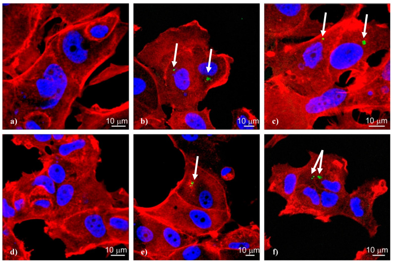 Confocal microscopy images of MCF-7 cells after 24-h incubation with fluorescein labelled siRNA: (a) Bcl-2, (b) CBD-1/Bcl-2, (c) CBD-2/Bcl-2, (d) Mcl-1, (e) CBD-1/Bcl-2, (f) CBD-2/Mcl-1. The concentration of siRNA was 0.1 µM and the dendrimer/siRNA charge ratio was 20:1. Arrows indicate complexes dendrimer/siRNA.