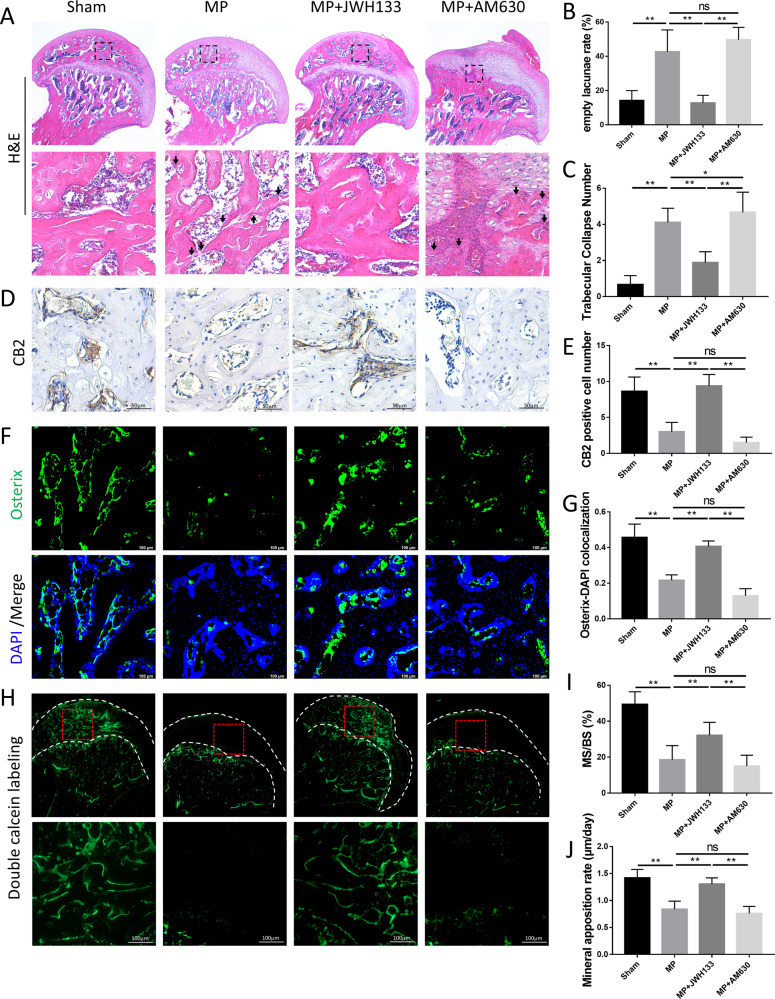 Histological staining, histomorphometric analysis, and CB2 expression in GC-induced ONFH rat.A–C Hematoxylin and eosin (H&E) staining and histomorphometric analysis. D, E Immunohistochemical analysis showed significant differences of positive staining. F, G Immunofluorescence, green (Osterix), and blue (nuclei). H Representative images of double calcein labeling. I Mineralizing surface/bone surface (%). J Mineral apposition rate (μm/day) (n = 10 per group, data are shown as mean ± SD, *p < 0.05; **p < 0.01; ns, not significant).