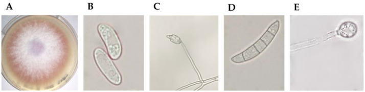 Putative Fusarium oxysporum morphological characteristics. In the figure: (A) pale violet colour of mycelia; (B) oval-shaped microconidia; (C) false heads of microconidia on a monophialide; (D) sickle-shaped macroconidia; (E) terminal chlamydospore.