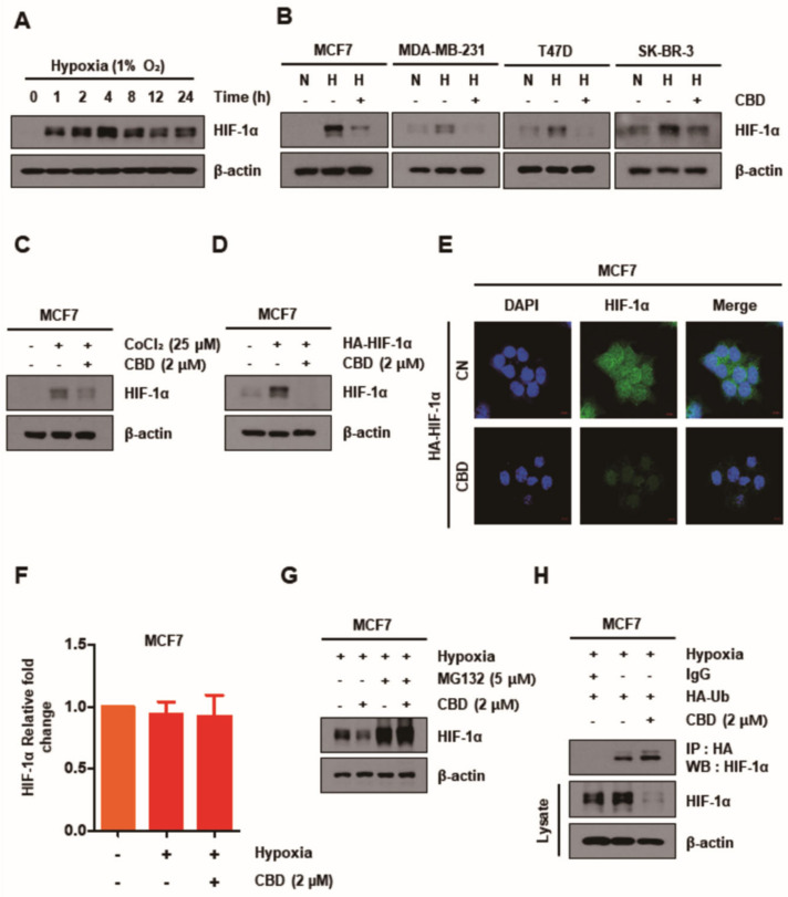 CBD decreases HIF-1α by post-transcriptional levels of HIF-1α regulating the ubiquitin proteasome (UPS) system. (A) MCF7 cells were treated with CBD (2 μM) for different time periods in hypoxia conditions. The expression of HIF-1α detected by Western blotting was significantly increased after 4 h. (B) Breast cancer cell lines were treated with CBD (2 μM) for 24 h. The protein level of HIF-1α was detected by Western blotting. (C,D) MCF7 cells were chemically induced with CoCl₂ (25 µM) or transfected with HA-HIF-1α plasmid. Then, cells were treated with CBD (2 μM) for 24 h in normoxia conditions. The protein level of HIF-1α was detected by Western blotting. (E) MCF7 cells were transfected with HA-HIF-1α plasmid and then treated with CBD (2 μM) in normoxic conditions. Immunofluorescence images showed the expression of HIF-1α. (F) The mRNA level of HIF-1α was measured by qRT-PCR. (G) MCF7 cells were pretreated with proteasome inhibitor (MG132) (5 µM). After 1 h pretreatment, the cells were treated with CBD (2 μM) for 24 h. The protein level of HIF-1α was detected by Western blotting. β-actin was used as a loading control. (H) MCF7 cells were transfected with HA-Ub plasmid and then treated with CBD (2 μM) for 24 h. HIF-1α was isolated by immunoprecipitation with IgG and anti-HA antibody, followed by immunoblotting for HIF-1α; total HIF-1α and β-actin protein levels were detected by Western blotting. CBD; cannabidiol, CN; control, N; normoxia, H; hypoxia.