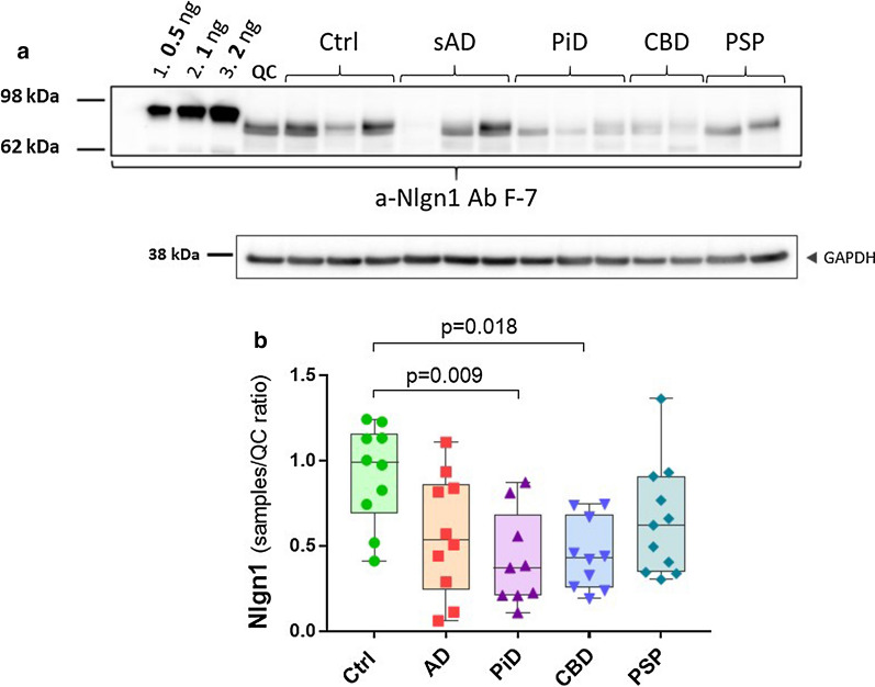 Nlgn1 reduction in frontal grey matter of tauopathies. Nlgn1 levels analysed in a tauopathies cohort including AD (n = 10), PiD (n = 9), CBD (n = 10), PSP (n = 11) and Ctrl (n = 10) from frontal grey matter. a representative Western blot and relative GAPDH signal. Samples were run as singlicates. A calibration curve of recombinant Nlgn1 fusion protein was used to estimate the amount of Nlgn1 present in the samples (as above). b The bars presented in the scatterplots show the median and the interquartile range. Significance: p ≤ 0.05