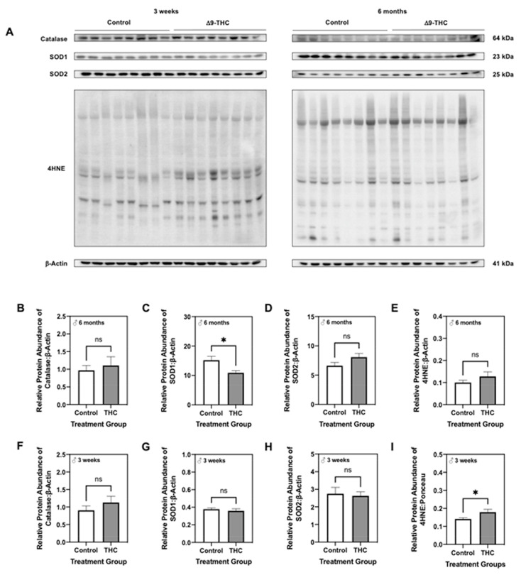 Gestational exposure to Δ9-tetrahydrocannabinol (Δ9-THC) results in hepatic oxidative stress within male offspring at three weeks and six months of age. (A) Representative western immunoblots illustrating hepatic expression of catalase, superoxide dismutase (SOD) 1, SOD2 and 4-hydroxynonenol (4HNE) in male offspring at three weeks and six months. Protein abundance of catalase (B,F), SOD1 (C,G), and SOD2 (D,H) were normalized to β-Actin ± SEM (n = 7–8/group), while 4HNE abundance (E,I) was expressed as means normalized to total protein abundance ± SEM (n = 7–8/group). All protein abundances were analyzed using a two-tailed unpaired Student’s t-test. * Significant difference (p < 0.05).