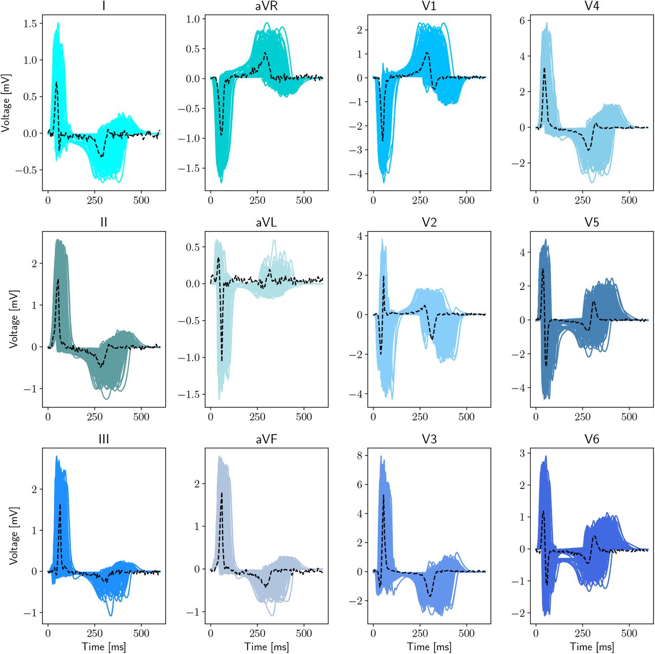 Physics-based electrophysiological modeling dataset generation. Full dataset containing 200 in silico precordial and limb leads recordings (blue, solid) and patient-specific 12-lead ECGs (black, dashed).