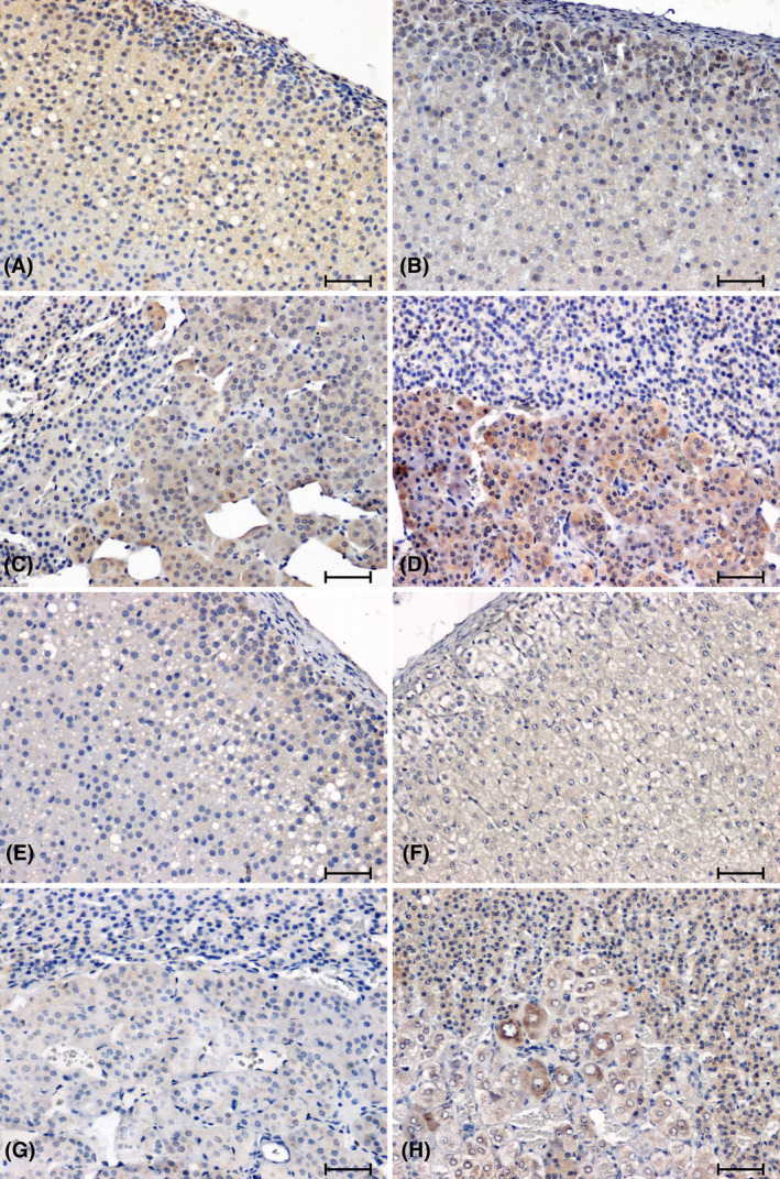 Immunodetection of CacyBP/SIP in adrenal glands of normotensive (A–D) and hypertensive (E–H) rats. Adrenal cortex and medulla of WKY (A, C), sham‐operated rat (B, D); Adrenal cortex and medulla of SHR (E, G); 2K1C rat (F, H). Scale bar = 50 μm.