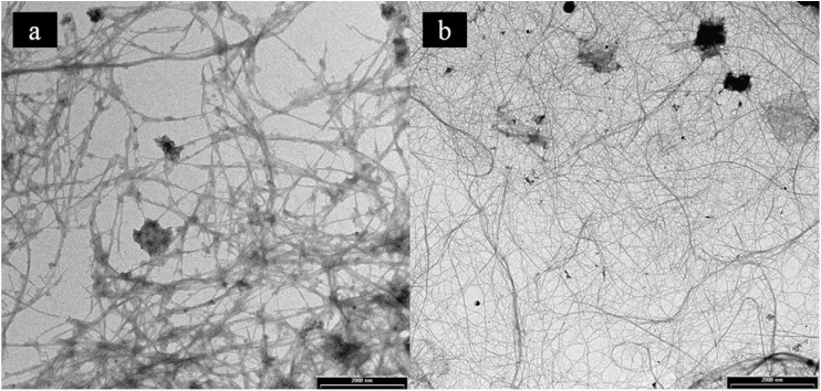 Image of banana peel cellulose fibers; (a) obtained by chemical treatment and (b) obtained by enzymatic treatment, (scale bar 2000 nm). Reproduced from ref. 152 with permission from Elsevier, Copyright 2014.