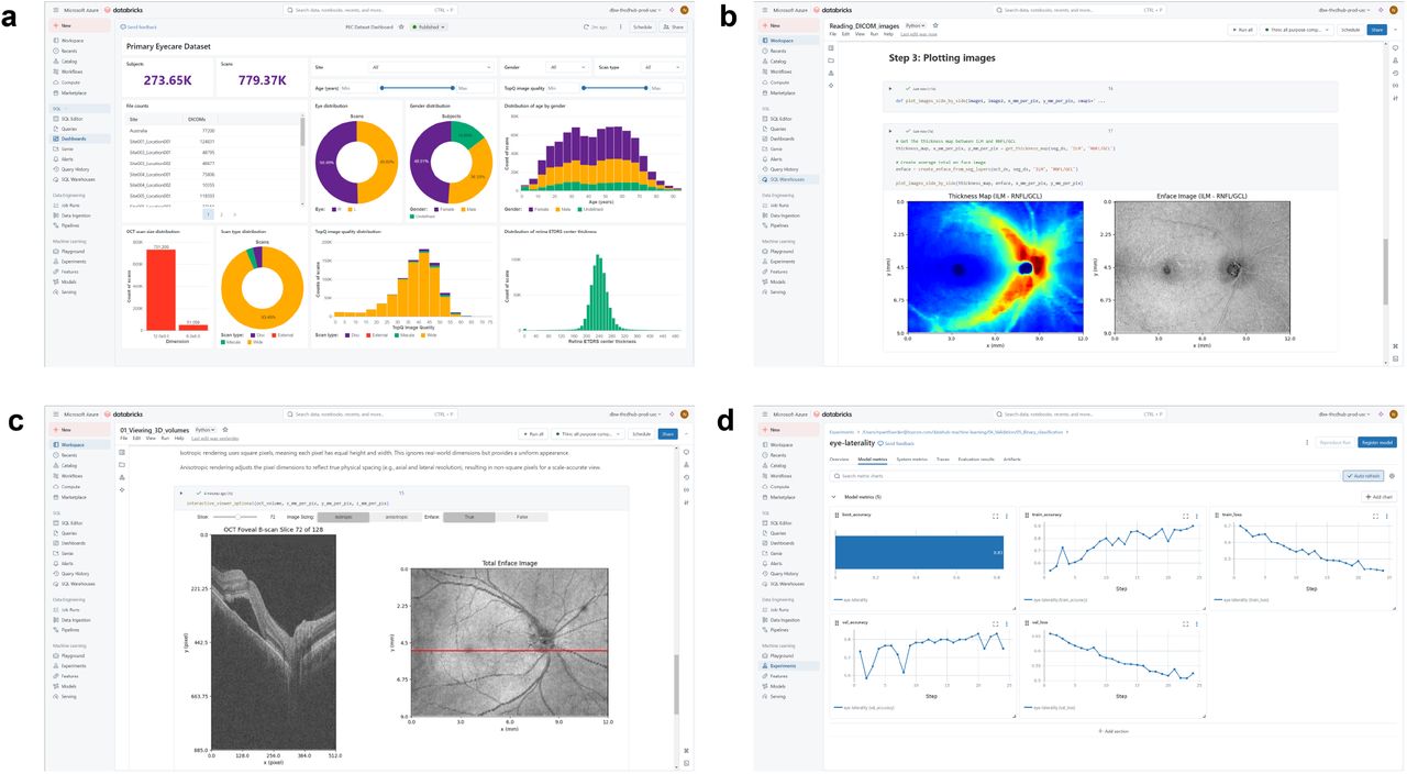 Microsoft Azure Databricks workspace. a) Interactive dashboards for data exploration. b) Reading segmentation DICOM files to generate enface projections and retinal thickness maps. c) Scrolling through OCT volumes using interactive elements coded using Python in Notebooks. d) Tracking the performance of machine learning experiments during training and validation.