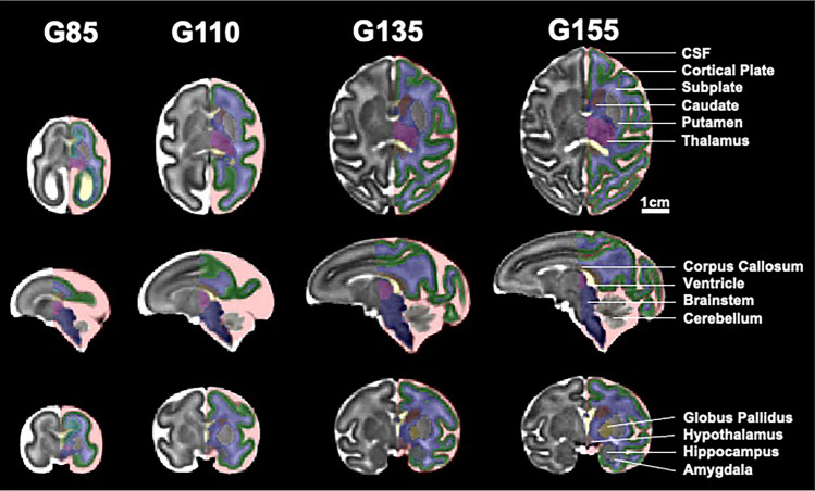 Study templates with regional segmentation overlays. Representative axial (top row), sagittal (middle row), and coronal (bottom row) views of the four T2-weighted gestational age study templates with color-coded segmentations partially overlaid. Regions corresponding to external CSF (red), cortical plate (green), fetal white matter (blue), germinal matrix (cyan), ventricles (yellow), corpus callosum (bronze), thalamus (magenta), hypothalamus (puce), caudate (brown), putamen (silver), globus pallidus (gold), hippocampus (grey), amygdala (light grey), cerebellum (tan), and brainstem (indigo) are visible. Scale bar represents 1 cm.