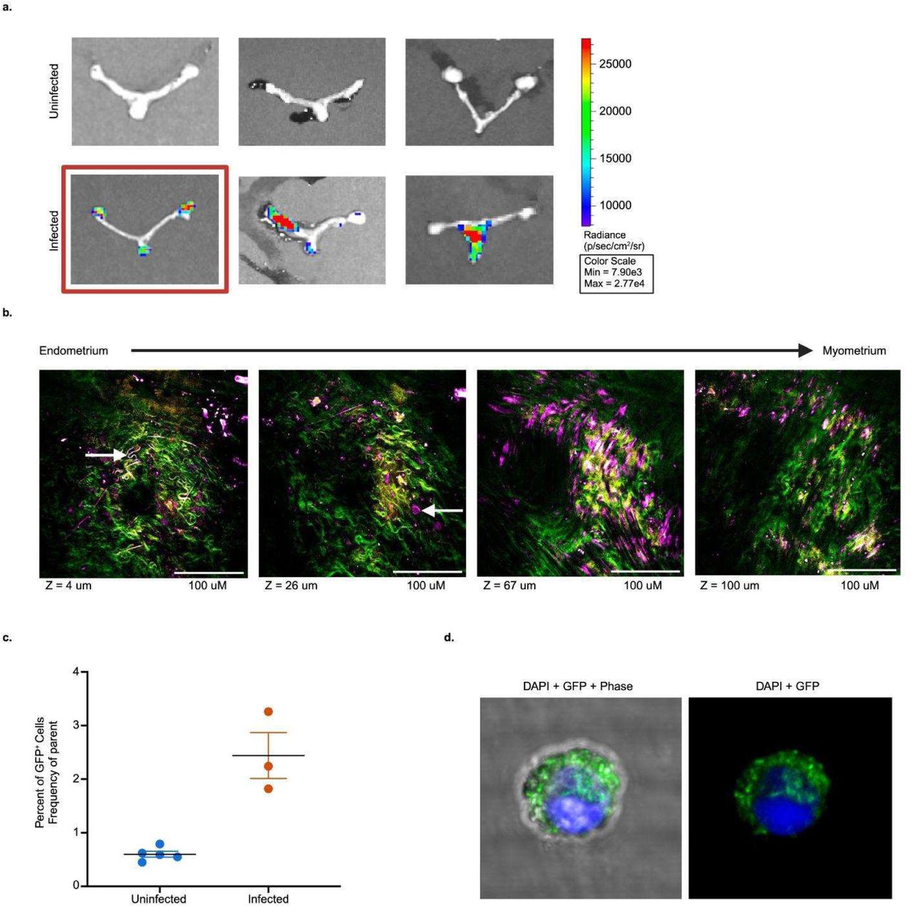 B. burgdorferi is present in the reproductive tract of infected mice.A. Representative In Vivo Imaging System (IVIS) images of female C57BL/6 (B6) murine reproductive tract tissue intradermally infected (105 bacteria) with ML23 Luc-B. Burgdorferi for 9 weeks. Images were normalized across all cages for better visualization with a set radiance (7.90 × 103 to 2.77 × 104 p/sec/cm2/sr). B. Nonlinear imaging of Luc-B. burgdorferi infected uterine tissue from red-boxed Figure 1A spanning from endometrium to myometrium with Z=4-100 uM. Collagen is represented in green and lipid interface is represented in purple. C. Percent of GFP+ reproductive tract tissue digested cells of B6 mice that were uninfected (N=5) versus infected with GFP-B. burgdorferi (N=3), 12-months post-intraperitoneal injection with GFP-B. burgdorferi. Baseline was set such that GFP positivity in uninfected mice is under 1%. D. Microscopy of fluorescence activated cell sorted GFP+ reproductive tract tissue digestion cells from female B6 mice infected with GFP-B. burgdorferi, 15-months post-intraperitoneal injection with GFP-B. burgdorferi. DAPI is represented in blue and GFP is represented in green.