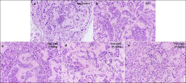 Microscopic histopathology of subcutaneous tumors in mice injected with Michigan Cancer Foundation-7 breast cancer cell line and subsequently administered (a) negative control, gavaged with sesame oil; (b) positive control, treated with 5-fluorouracil (5-FU, 20 mg/kg, intraperitoneally, three times per week); (c) THC:CBD (1:6) low-dose group, gavaged at 2 mg/kg BW; (d) THC:CBD (1:6) intermediate-dose group, gavaged at 10 mg/kg BW; (e) THC:CBD (1:6) high-dose group, gavaged at 20 mg/kg BW. Sections were stained with hematoxylin and eosin (H&E) and examined at 40× magnification. 5-FU = 5-fluorouracil, BW = Body weight, THC: CBD = tetrahydrocannabinol:cannabidiol.