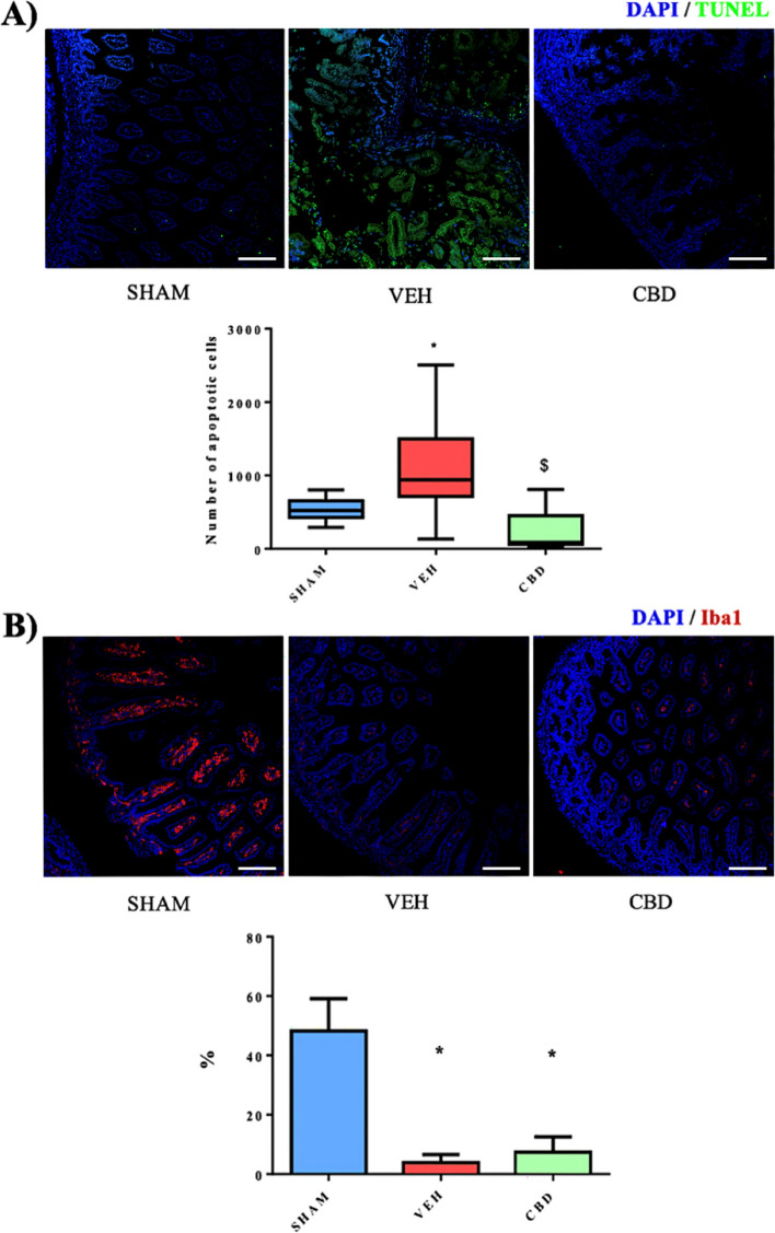 A Immunofluorescence (x20) with DAPI (cell nuclei in blue) and TUNEL (apoptotic cell nuclei in green) antibodies of SHAM, VEH and CBD groups and comparison of the variation of the absolute number of apoptotic cells of the 3 study groups at 72h (p < 0.05). Scale 100 microns. B Immunofluorescence (x20) with DAPI antibodies (cell nuclei in blue) and Iba-1 (macrophages in red) of the SHAM, VEH and CBD groups and comparison of the variation of the percentage of Iba-1 with respect to DAPI of the 3 study groups at 72h (p < 0.05). Scale 100 microns. * significant difference compared to SHAM, $ significant difference compared to VEH