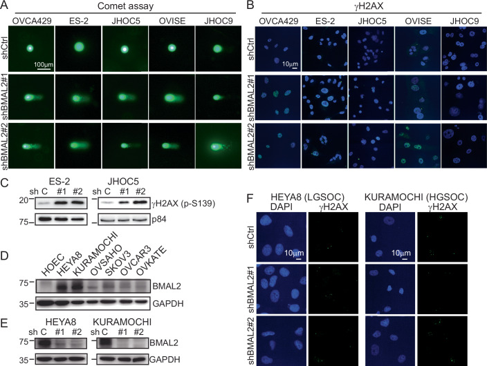 BMAL2 depletion increases endogenous DNA damage in OCCC cells, but not serous type ovarian cancers.(A) Representative comet assay images of OCCC cells without (shCtrl) or with BMAL2 depletion (shBMAL2#1 or #2). These cells were not treated with DNA damage agents. Scale bar indicates 100 µm. (B) Representative γH2AX staining of shCtrl and shBMAL2 OCCC cells. These cells were not treated with DNA damage agents. Scale bar indicates 10 µm. (C) IB of γH2AX protein with p84 as a nuclear protein loading control. Blots shown are from one representative experiment of three replicates. (D) IB of BMAL2 protein expression with GAPDH as a loading control in serous ovarian cancer cell lines. Blots shown are from one representative experiment of three replicates. (E) IB of BMAL2 protein expression with GAPDH as a loading control in BMAL2-depleted (shBMAL2#1 or #2) HEYA8 and KURAMOCHI cells. Blots shown are from one representative experiment of three replicates. (F) Representative γH2AX staining of shCtrl and shBMAL2 serous type OC cells. These cells were not treated with DNA damage agents. Scale bars indicate 10 µm. Source data are available online for this figure.