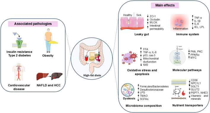 Main effects of HFDs on intestinal structure and metabolism. HFD is associated with several metabolic diseases, including insulin resistance, type 2 diabetes mellitus (T2DM), obesity, cardiovascular disease, NAFLD, and hepatocellular carcinoma (HCC). These effects are mediated through alterations in gut structure and function, leading to increased permeability (leaky gut). The mechanisms include: 1) decreased expression of tight junction proteins, such as ZO-1, occludin, and MLCK; 2) inflammation, characterized by an increased release of inflammatory cytokines and a reduction in IELs and LPLs; 3) dysbiosis, with an increased production of trimethylamine (TMA) and a decreased production of SCFAs; 4) impaired nutrient transport due to low expression of key nutrient transporters, including fatty acid translocase (FAT/CD36), fatty acid transport proteins (FATPs), Niemann-Pick C1-like 1 (NPC1L1), sodium-glucose co-transporter 1 (SGLT1), glucose transporter 2 (GLUT2), and 5) altered function of peptide transporter 1 (PEPT1) and sodium-hydrogen exchanger 3 (NHE3).