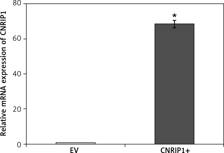 CNRIP1 mRNA expression levels in colon cancer cells before and after transfection with a CNRIP1-overexpression plasmid. The mRNA expression significantly increased (p < 0.05) within cells transfected with a CNRIP1-overexpression plasmid (68.30 ±2.08) relative to SW620 cells within the EV group (1.00 ±0.04)