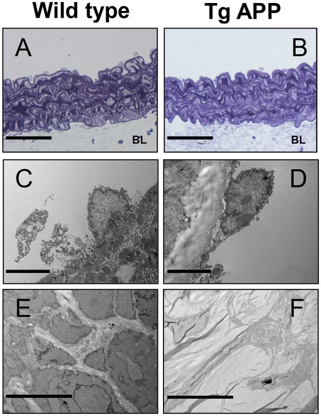 Electron micrographs of wild type and Tg APP mice. Representative images are shown for wt (A,C,E) and Tg APP mice aortae (B,D,F). (A,B) toluidine blue micrographs showing similar structure (n = 20 animals/per group). BL: basal lamina, (C,D) endothelial cells show similar appearance (wt n = 4, Tg APP n = 6). (E) smooth muscle cells surrounded by collagen in wt mice aorta, (F) muscle cells are embedded in collagen in Tg APP aorta (wt n = 4, Tg APP n = 6). Scale bars, 50 μm in (A,B); 100 nm in (C–F).