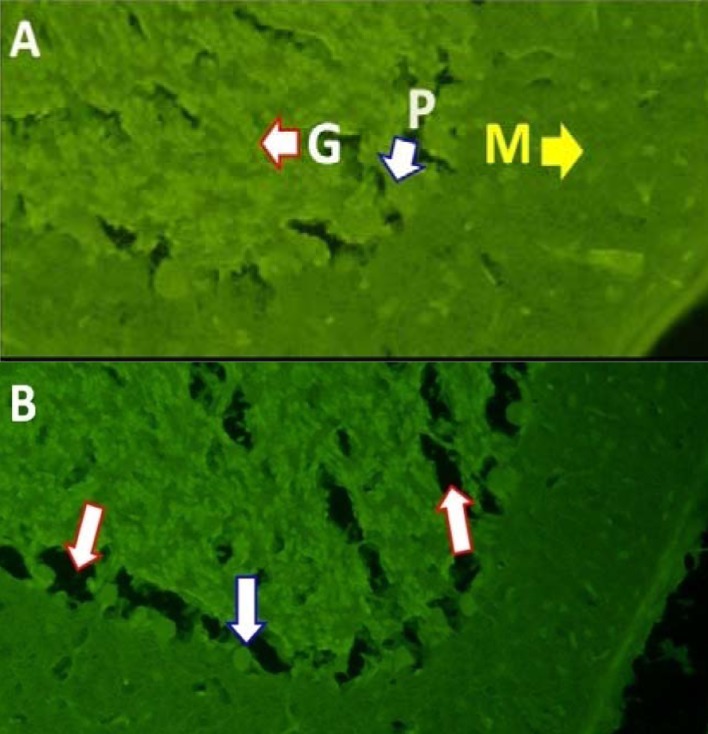 Figure A illustrates the order of cerebellar cortical layers and high density of Purkinje cells in the control rats (molecular layer (M), Purkinje cell layer (P) and granular layer (G). Figure B illustrates different cerebellar cortex layers 30 days after birth of rats treated with WIN 55212-2 during embryonic period. In the treated group, Purkinje neuron cells are irregular and shattered and with lower density than the control group. The red arrowhead indicates the places damaged and the blue arrowhead indicates cell bodies from healthy Purkinje cells.