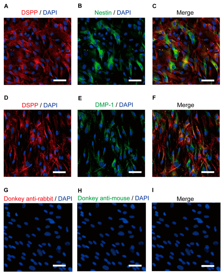 Immunofluorescence analysis of the DSPP, nestin, and DMP-1 human odontoblast markers. (A,B,D,E) Human odontoblasts showed positive immunoreactivity to the dentin sialophosphoprotein (DSPP) (red in (A,D)), nestin (green in (B)), and dentin matrix protein 1 (DMP-1) (green in (E)). (C,F) Triple immunofluorescence staining with antibodies against the DSPP (red) and nestin (green) (C) or DMP-1 (green) (F). (G–I) No fluorescence was detected in the negative control omitting the primary antibody to control the specificity of the immunostaining with Alexa 488 and/or 568. Nuclei are shown in blue. Scale bars; 50 µm.