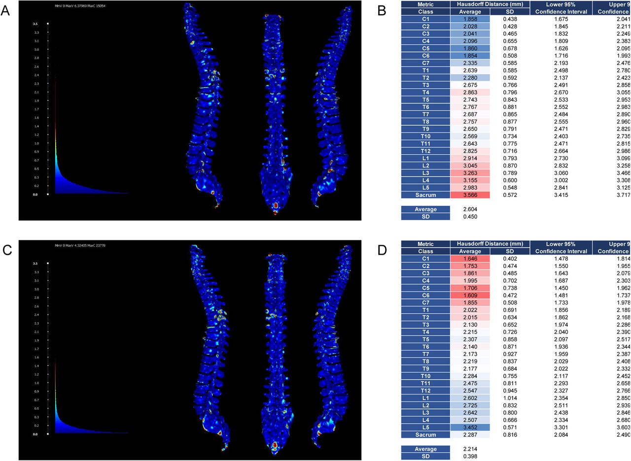 Comparison of spineCT-ResSegNet and spineCT-nnUNet semantic segmentation models.(A) Example of the Hausdorff distance calculation between the spineCT-ResSegNet model (native to MONAI-Label) predictions and ground truth. (B) Average Hausdorff distance calculation for spineCT-ResSegNet predictions versus their ground truth. Predictions with the spineCT-ResSegNet model average a Hausdorff Distance of 2.604±0.450 mm to the ground truth. (C) Example of the Hausdorff distance calculation between the spineCT-nnUNet model predictions and ground truth. (D) Average Hausdorff distance calculation for spineCT-nnUNet predictions versus their ground truth. Predictions with the spineCT-nnUNet model average a Hausdorff Distance of 2.214±0.398 mm to the ground truth. Color encoding in (B) and (D) correlates with the accuracy of segmentation class predictions. Blue indicates high similarity to the ground truth, while red represents increasing deviation from the actual values.