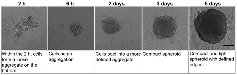Morphology analysis by phase-contrast microscopy of the D384 spheroid formation over a 5-day period in 96-well spheroid microplate. At 2–6 h after seeding, D384 cells appeared without total compactness. On day 5, complete D384 spheroid formation was observed and this time point was chosen as the starting point for drug treatments. Scale bar: 100 µm.