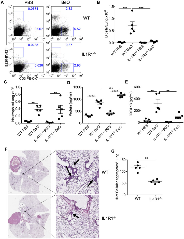 IL-1R1 signaling controls BeO-induced B cell recruitment to the lungs. Wildtype (WT) and interleukin-1 receptor 1 knockout (IL-1R1-/-) mice were exposed to BeO and sacrificed on day 21. (A) Flow cytometry plots show the recruitment of adaptive immune cells in the lungs of PBS or BeO-exposed mice. Graph plots show a total number of tissue-specific B220+ B cells (B) and neutrophils (C) in the lungs of PBS and BeO exposed WT and IL-1R1-/- mice on day 21. (D) Total protein concentration in the BALF measured by BCA, and (E) CXCL13 levels in the BALF on day 21 measured by ELISA. (F) Hematoxylin and eosin (H&E) staining of BeO-exposed lung tissues from WT (top) and IL-1R1-/- (bottom) mice. (G) Cellular aggregates in the lungs of WT and IL-1R1-/- mice exposed to BeO were quantified using QuPath. Data are representative of three independent experiments having n=5 mice per group. One-way ANOVA was used to test statistical differences among the groups. P<0.05 (*) is considered statistically significant. P < 0.01 (**), P < 0.001 (***), P < 0.0001 (****).