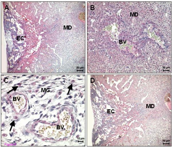 CB1 and TRPV1 immunoreactivity on day 12 of pregnancy. (A) CB1 expression in decidualized cells in the mesometrial region; note that positive staining was restricted to the edges of mesometrial decidua nearest to the ectoplacental cone, which also is positive for CB1; (B) Expression of CB1 in the endovascular trophoblast cells; (C) Expression of CB1 in the metrial gland. Smooth muscle cells of blood vessels and uNK cells (arrows) are positive; (D) TRPV1 expression in decidualized cells in the mesometrial region in the vicinity of ectoplacental cone, which show some positivity. BV - Blood vessel; EC - Ectoplacental cone; MD - Mesometrial decidua; MG - Metrial gland.