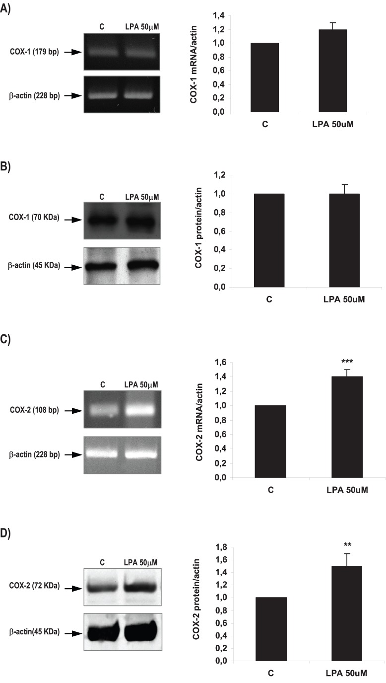 Effect of LPA on COX-1 and COX-2 expression in the rat uterus during the window of implantation.Uterine strips from rats pregnant on day 5 of gestation (implantation window) were incubated with LPA 50 µM for 6 h and the expression of COX-1 mRNA (A) and protein (B) and of COX-2 mRNA (C) and protein (D) was studied. In C: *** p<0,001 vs C; In D: ** p<0,01 vs C. Results are shown as means ± sem. N = 4–6 for each point. C: control.