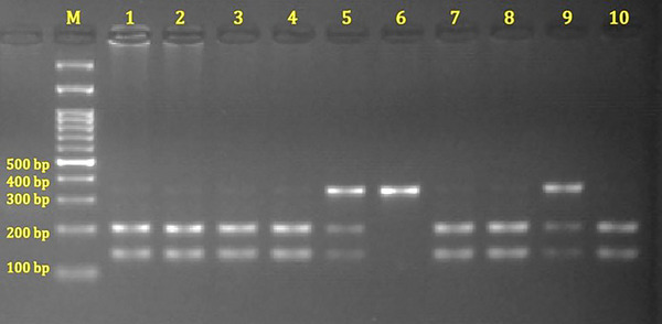 Agarose gel electrophoresis image of PCR products of the rs324420 polymorphism in the FAAH gene. M: DNA ladder; lines 1–4, 7, 8, 10: CC (200 bp and 138 bp); lines 5, 9: CA (338 bp, 200 bp, and 138 bp); line 6: AA (338 bp).