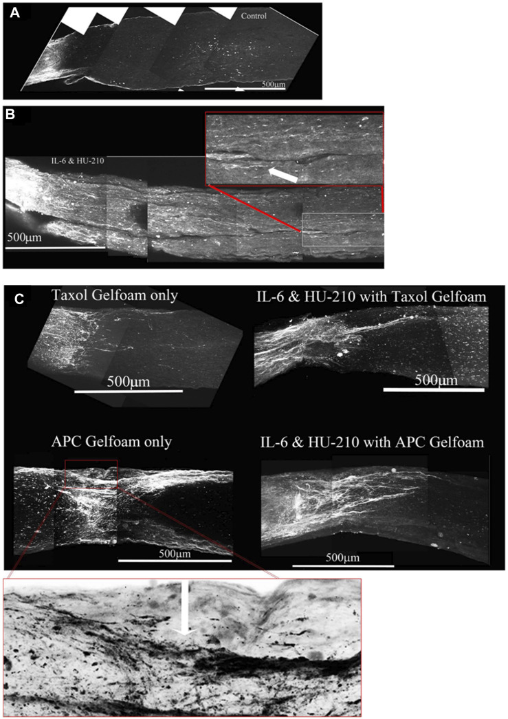 Addition of Taxol and/or APC promotes longer axonal regeneration. (A) CTB-labeled regenerating axons within the whole nerve were detected after applying the 3-DISCO clearing technique. Control animals had clear crush sites with few fibers crossing 3 weeks after injury. (B) However, with IL-6 and HU-210 treatment we could detect CTB-labeled axons within the nerve bundle shown, above the boxed panel is a magnified region demarcated by the red box, showing the extent of regenerating axons over 2 mm away from the crush site, as pointed out by the white arrows. (C) Taxol applied in gelfoam alone had promoted limited axonal regeneration. Adding Taxol gelfoam with IL-6 and HU-210 injections resulted in more robust growth, but still less than 1 mm from the crush site. APC gelfoam alone also promoted modest axonal regeneration from the crush site. Slightly more robust growth is detected when we combine IL-6 and HU-210 with APC gelfoam. The CTB-labeled axons are growing towards the edge where the APC-gelfoam was applied. In the enhanced and inverted image of APC gelfoam demarcated by the red box, we show the crush site that was treated with APC-gelfoam over the injury site. The white arrow in the inverted image of the original emphasizes the crushed fibers that are regenerating, as determined by CTB-labeling.