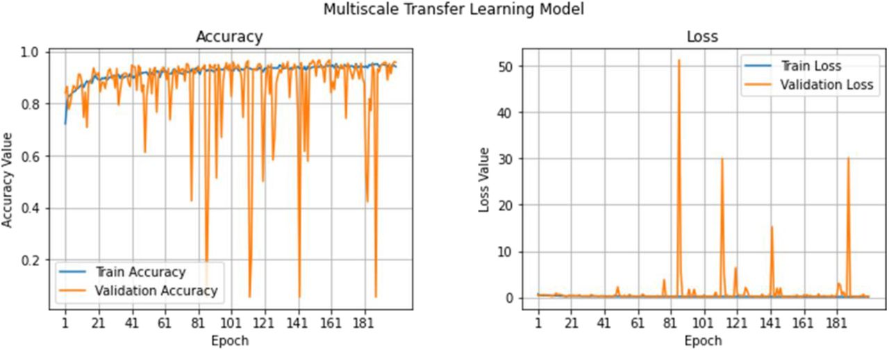 Training progress for 3-class dataset: (Left) training and validation accuracy (higher is better), and (Right) training and validation loss (lower is better)