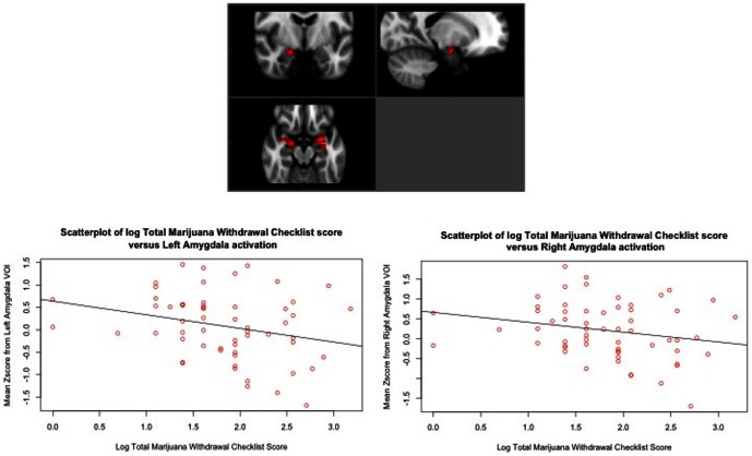 Negative correlations between marijuana withdrawal checklist (MWC) and anticipation of LOSS (vs. NEUTRAL) BOLD response in bilateral amygdala (shown below).Significant at cluster-corrected p<.05, z = 1.96. For the scatterplots, an anatomical mask of the amygdala was created based on the definition described by Tzourio-Mazoyer and colleagues [64].