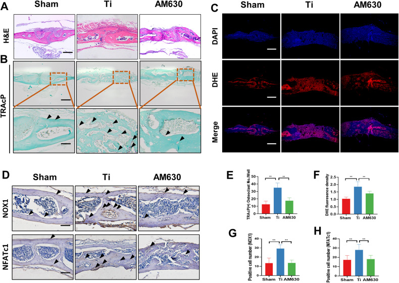 Inhibition of CB2 inhibited the number of osteoclasts and ROS levels in osteolytic mice.A H&E staining of skulls, Scale bar = 100 µm. B, E TRAcP staining of the skull and quantitative analysis of osteoclasts in each group of mice. Scale bar = 100 µm. C, F ROS staining and quantitative analysis of immunofluorescence staining in each group of mice, Scale bar = 100 µm. D, G, H Immunohistochemical staining and quantitative analysis of NOX1 and NFATc1 in decalcified bone sections. n = 7 per group. The data were represented as mean ± SD. Statistical significance was determined by a one-way ANOVA with Tukey’s multiple-comparison test. *P < 0.05, **P < 0.01.
