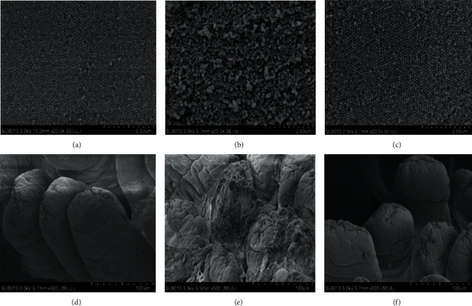 Effect of HSP on ultrastructure of jejunum. (Con (a), Cy (b), and Cy+HSP (c), SEM 20x; Con (d), Cy (e), and Cy+HSP (f), SEM 500x).