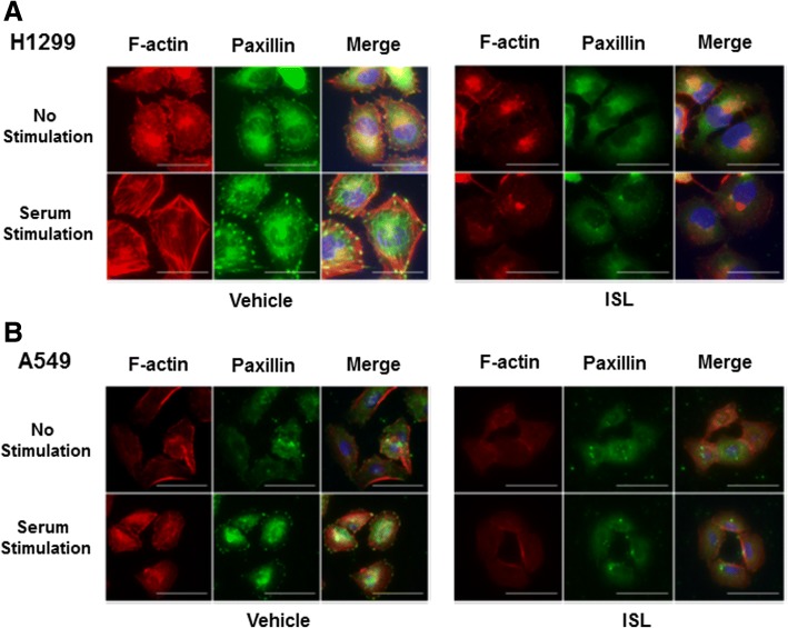 ISL abolishes serum-induced actin reorganization and focal adhesion assembly. H1299 (a) and A549 cells (b) were treated with vehicle or 10 μM ISL for 24 h in serum-free condition, then stimulated with 10% FCS for 1 h followed by immunostaining with phalloidin (red) and paxillin mAb (green). A representative view was chosen for photography