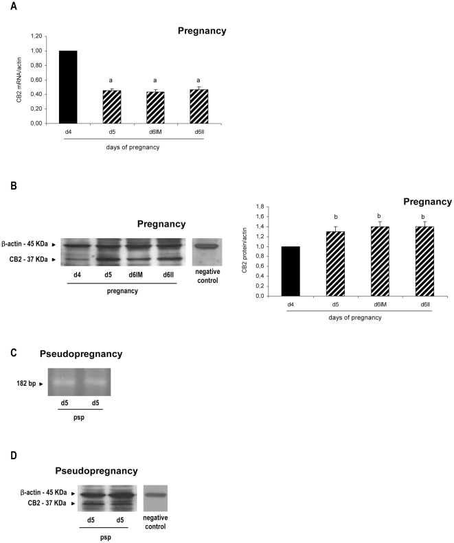 Expression of cannabinoid receptor type-2 at implantation and pseudopregnancy.Cannabinoid receptor type-2 (CB2) messenger (A and C) and protein (B and D) were detected during peri-implantation (A and B) and on day 5 of pseudopregnancy (C and D). Results are shown as means ± S.E.M. N = 4–6 for each point. a: p<0.01 vs day 5, b: p<0.05 vs day 4. d4: day 4, d5: day 5, d6: day 6, IM: implantation sites, II: inter-implantation sites, psp: pseudopregnancy.