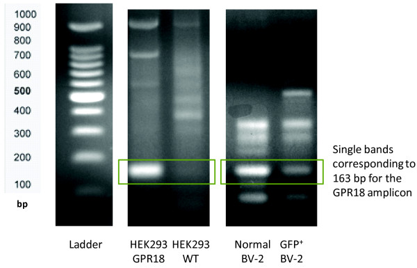 GPR18 mRNA levels in siRNA transfected BV-2 microglia. Gel electrophoresis of HEK293-GPR18, HEK293 WT, Normal BV-2 microglia and GFP+ GPR18 siRNA transfected BV-2 microglia RT-PCR products run on a 2% agarose gel.