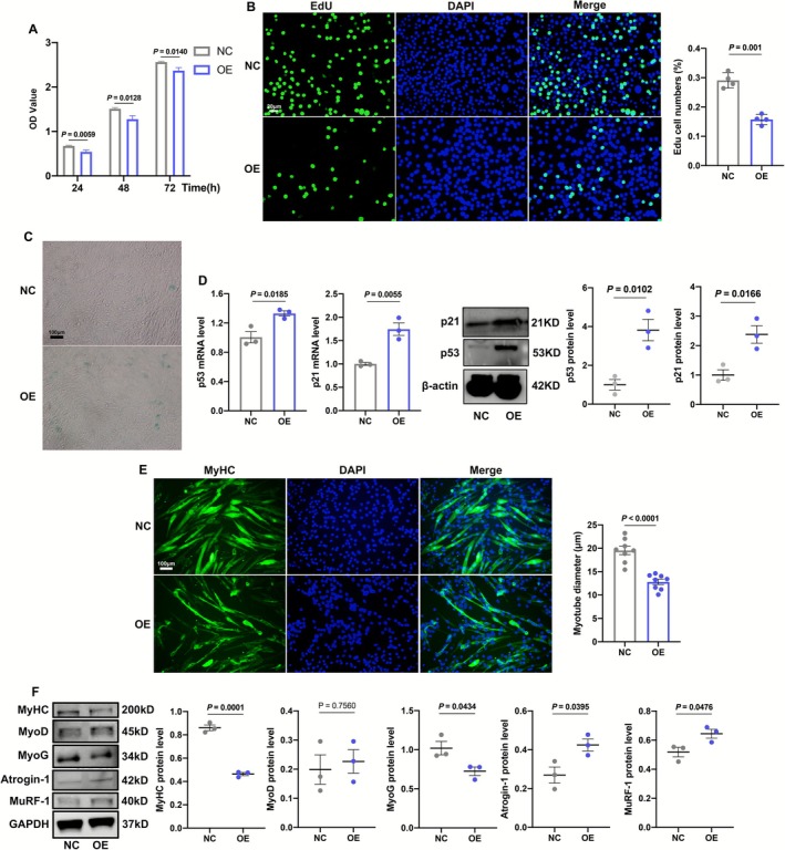 Effects of ANXA2 overexpression on proliferation, senescence and myogenic differentiation of C2C12 cells. (A) OD values of C2C12 cells in NC and OE groups at 24, 48 and 72 h by CCK‐8 (n = 8). (B) Representative images of EdU positive C2C12 cells in NC and OE groups and statistical results by immunofluorescence (n = 4). (C) S‐β‐Gal staining of C2C12 cells in NC and OE groups. (D) The RNA and protein levels and statistical results of p53 and p21 in C2C12 cells in NC and OE groups by qRT‐PCR and Western Blot (n = 3). (E) Representative images of MyHC staining of C2C12 myotubes in NC and OE groups and statistical results of diameters of myotubes by immunofluorescence (n = 8). (F) The protein levels and statistical results of MyHC, MyoD, MyoG, Atrogin‐1 and MuRF‐1 in C2C12 myotubes in NC an OE groups by Western Blot (n = 3). Values are represented as means ± SEM. Exact p values are shown.