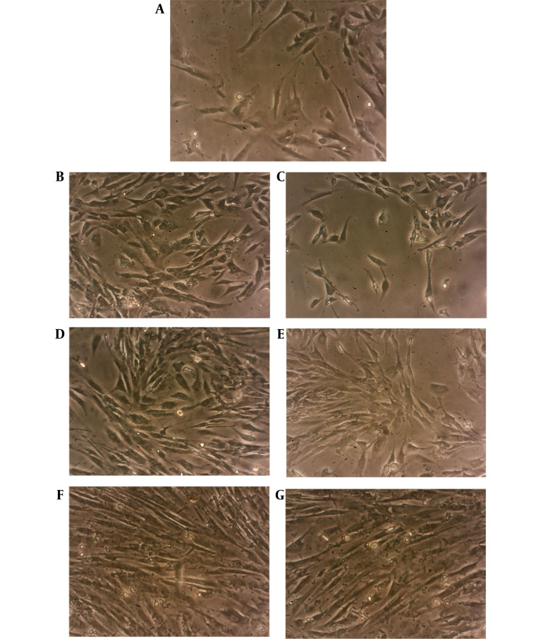 A, HCM cells in day 0 with elongated or rod-shaped appearance; B, HCM cells in the case group; and C, control group in day 1. Note to the higher cell density in the case cells due to augmented proliferation; D, HCM cells in the case group; and E, control group in day 3; F, HCM cells in the case group; and G, control group in day 6. Images were captured using inverted phase-contrast microscope (ECLIPSE, TS100, Nikon) equipped by a digital camera (magnification = 360X).