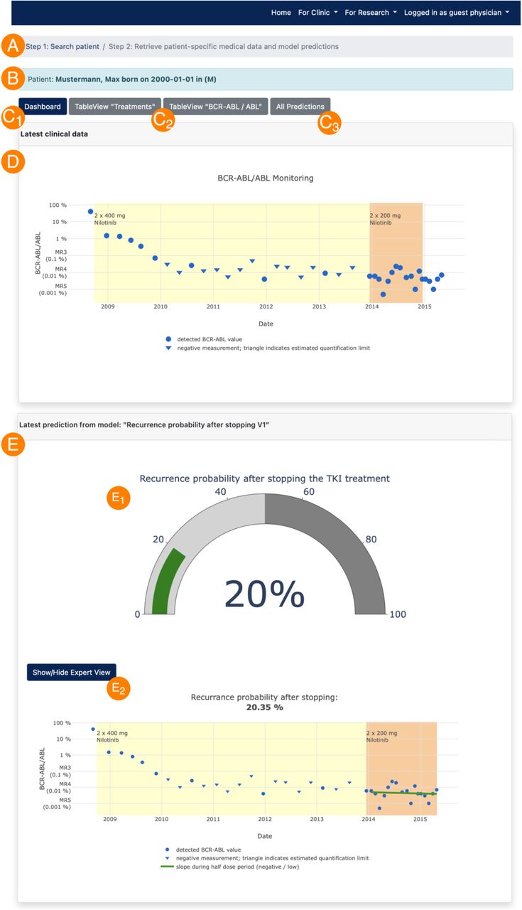 Clinic view:After searching for a patient by identifying data (A) and re-identification (B) of the pseudonymized medical data and simulation results, the latest medical data (D) and model predictions (E) are visualized as simplified and/or expert view (E1 and E2) in a dashboard (C1). Furthermore, the current medical data can be displayed and downloaded in table form (C2) and all previous predictions can be retrieved, too (audit trail compatibility, (C3) and Fig 4).