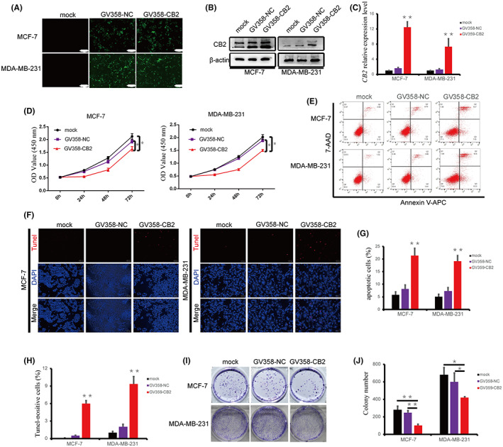 Overexpression of CB2 inhibited proliferation and promoted apoptosis of BC cells in vitro. (A) Green fluorescence was observed in BC cells transfected with CB2‐overexpression plasmid. Scale bar: 200 μm, 100×. (B) CB2 protein expression detected by western blot in BC cells transfected with CB2‐overexpression plasmid or control. (C) CB2 expression was successfully upregulated by transfection with CB2‐overexpression plasmid, as verified by qRT‐PCR. (D) Viability of MCF‐7 and MDA‐MB‐231 cells was evaluated by CCK‐8 assay. (E and G) Apoptosis was analyzed by flow cytometry after upregulation of CB2. (F and H) Apoptosis ability of BC cells was detected by TUNEL assay (scale bar: 100 μm, 200×). (I and J) Survival of BC cells transfected with CB2‐overexpression plasmid was assessed by colony formation assay. Data presented as mean ± SD, *p < 0.05, **p < 0.01.