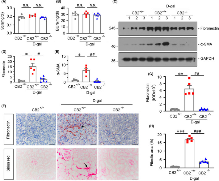CB2 deficiency retards age‐related kidney fibrosis. (A and B) Quantitative data showing serum creatinine (Scr) and blood urea nitrogen (BUN) levels in different groups. n.s.: no significance. (C–E) Representative Western blot and quantitative data showing renal expression of fibronectin and α‐SMA in different groups. Numbers (1–3) indicate each individual animal in a given group. *p < 0.05 versus the WT mice group alone; # p < 0.05, ## p < 0.01 versus the d‐gal‐treated WT mice group alone (n = 5–6). (F–H) Representative micrographs showing renal expression of fibronectin and Sirius red staining in different groups. Paraffin‐embedded kidney sections were stained with Sirius red and were immunostained with an antibody against fibronectin. Arrows indicate positive staining. Scale bar, 50 μm. Quantitative data showing quantification of positive staining of fibronectin (G) and fibrotic area (H). **p < 0.01, ***p < 0.001 versus the WT mice group alone; ## p < 0.01, ### p < 0.001versus the d‐gal‐treated WT mice group alone (n = 5–6)