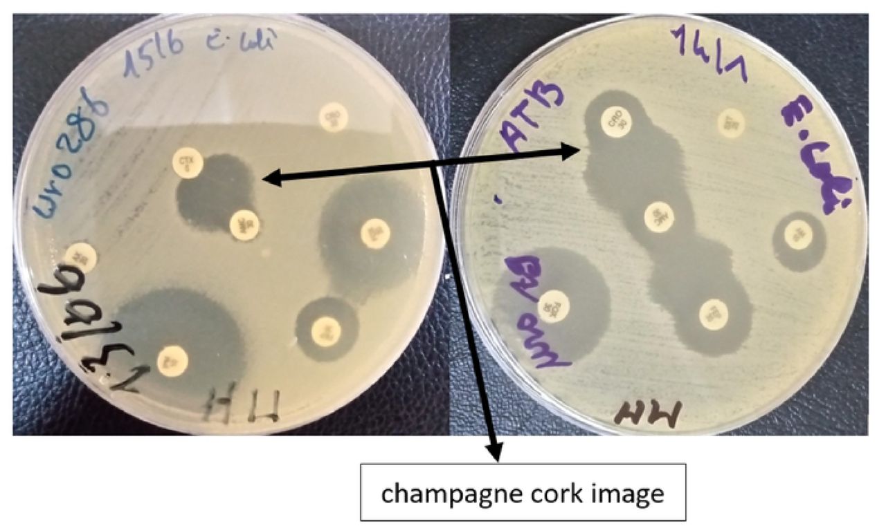 Phenotypic detection of ESBL production (Source: Coulibaly, 2024)