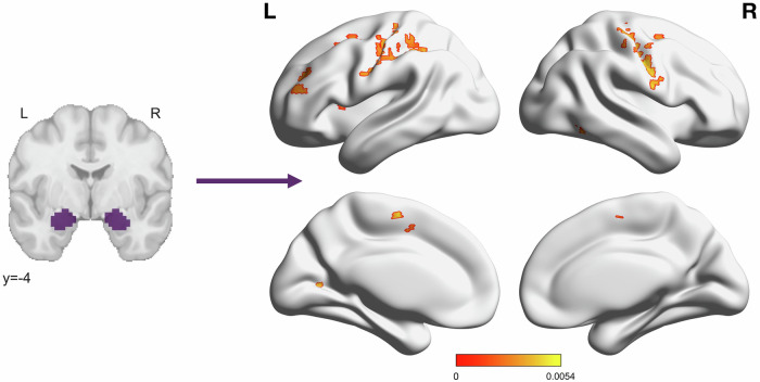 Self-reported PTSD symptoms positively associated with connectivity to the amygdala in multiple clusters throughout the brain.Color bar depicts standardized β values for the effect of week 4 PCL score in a model defined as PCL + Sex + Motion using AFNI’s 3dMVM. Significant cluster size was determined using a voxelwise threshold of p = 0.002 and cluster forming threshold of α = 0.05, corresponding to a cluster size of 11 voxels. Significant clusters were located in the bilateral postcentral gyrus and Rolandic operculum, left precentral gyrus, intraparietal sulcus, premotor cortex, rostral middle frontal gyrus, anterior insula, supplementary motor area, dorsolateral prefrontal cortex, frontal eye field, and primary visual cortex, and the right fusiform face area.