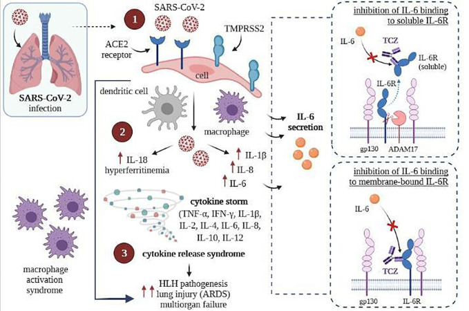 SARS-CoV-2 infection (left) and inhibition of intracellular signaling in cells by TCZ, resulting express of gp130 (right) [own drawing]. (1) Virus entry and infection of pneumocytes expressing the ACE2 receptor, recruiting antigen-presenting cells (dendritic cells and macrophages) into the lungs; (2) Activation of the NLRC4 inflammasome, which causes the overproduction of IL1β and IL 18, and causes the secretion of IL6 and ferritin by macrophages; (3) Upregulation resulting in cytokine release syndrome and macrophage recruitment to the lungs, contributing to ARDS.