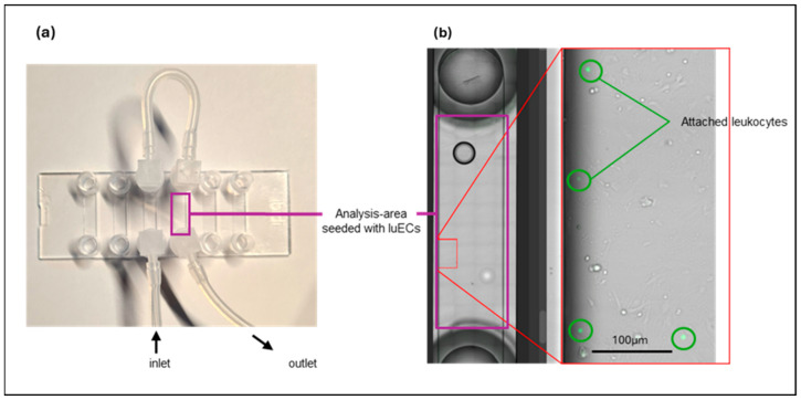 (a) Channel slides seeded with lung ECs (luECs in vivo) were perfused with 1 × 106 fluorescently labelled, activated leukocytes under unidirectional flow conditions for 30 min at a flow rate of 1 dyn/cm2. The complete channel is marked with a purple square. (b) View of one analyzed area (marked in red) of a channel (purple) at a magnification of 10×. Adherent leukocytes (green) were determined by automatic particle counting using ImageJ software in all areas of the channel (purple). Attached leukocytes (marked with green circles) were identified by color (green), size (above 5 pixels), and round shape (0.5 to 1.0).