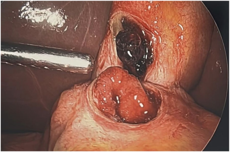 Fig. 6