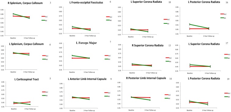 Group by time interactions for WM integrity showing decreasing FA in MJ and no effect of time in ALC (n = 16, p < 0.01); numbers corresponds to cluster order.