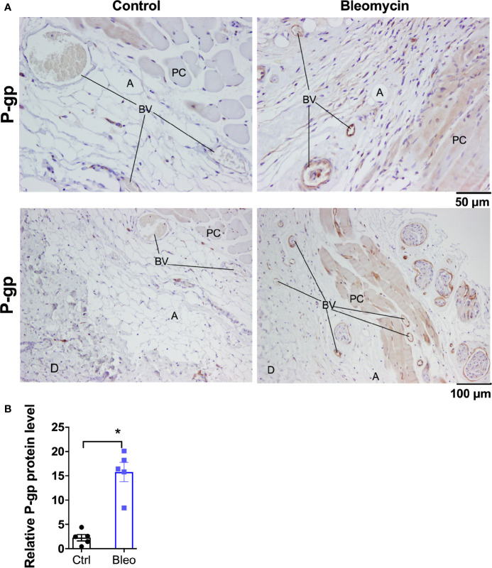 Bleomycin induces drug efflux transporter P-gp in skin of C57BL6/J mice. (A) Representative histological images for P-gp immunohistochemistry staining in skin biopsies of control and bleomycin-induced fibrotic skin. A, adipocytes; BV, blood vessels; D, Dermis; PC, Panninculus carnosus. (B) Quantification of P-gp protein expression in skin biopsies. Data represent mean ± SEM from five subjects in each group. Data were analyzed by t-test for comparison of histological scoring. * (p <0.05) indicates significant difference from the control group.